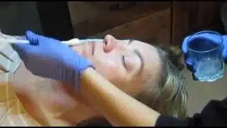 Enza Medispa – Chemical Peel