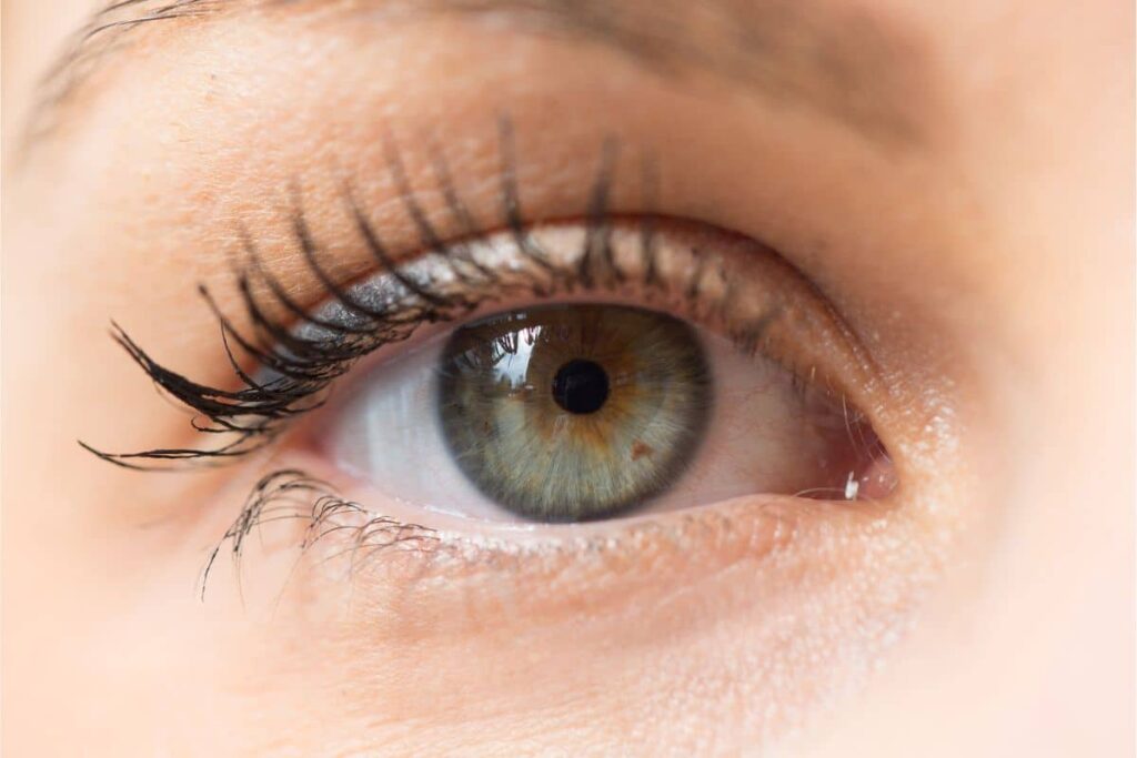 Close-up of an eye highlighting the results of lower blepharoplasty for removing under-eye bags.