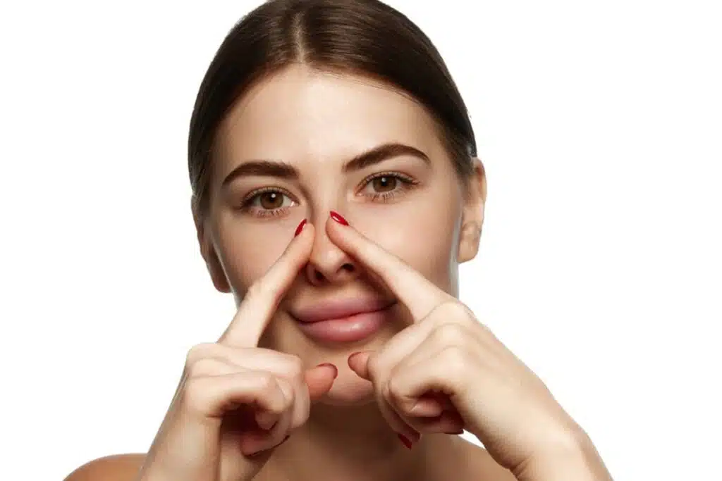 Close-up of a woman pointing to a small bump on the bridge of her nose following a rhinoplasty procedure, demonstrating common post-operative swelling and irregularities.