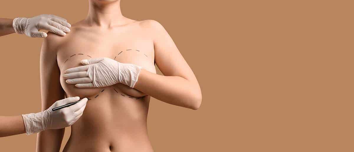Breast Enhancement Procedures